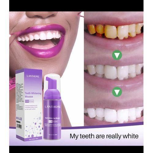 V34 teeth whitening and stain remover